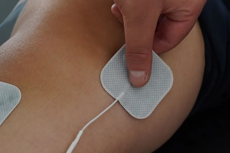 Applicazione di elettrodi adesivi per elettroterapia sulla schiena di un paziente